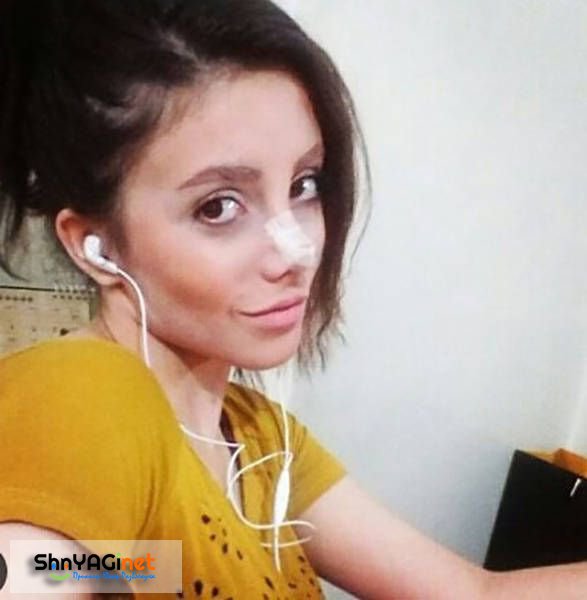 Девушка из Ирана по имени Сахар Тарбан перенесла 50 операций, чтобы стать похожей на Анджелину Джоли