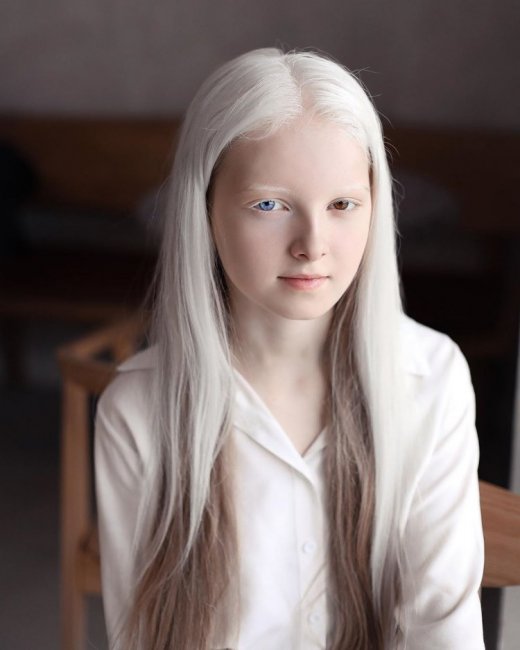 11-летняя девочка из Чечни с необычной внешностью