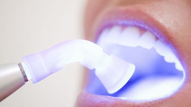 7 веществ, вредящих зубам, о которых вы даже не подозревали